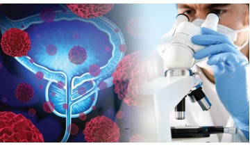 Boron Supports Optimum Prostate Health